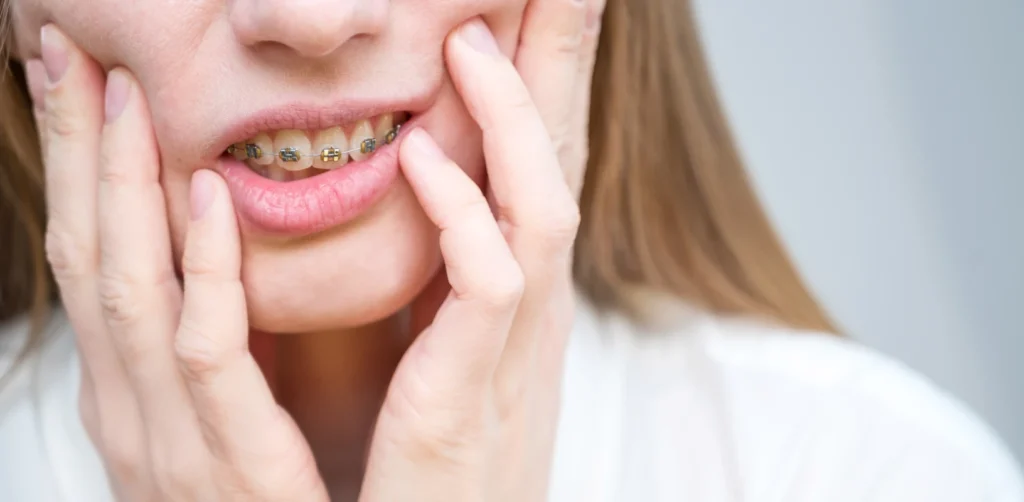 incidents orthodontie docteur baur truchtersheimIncidents en orthodontieCabinet d’Orthodontie du Dr Bernard Baur
