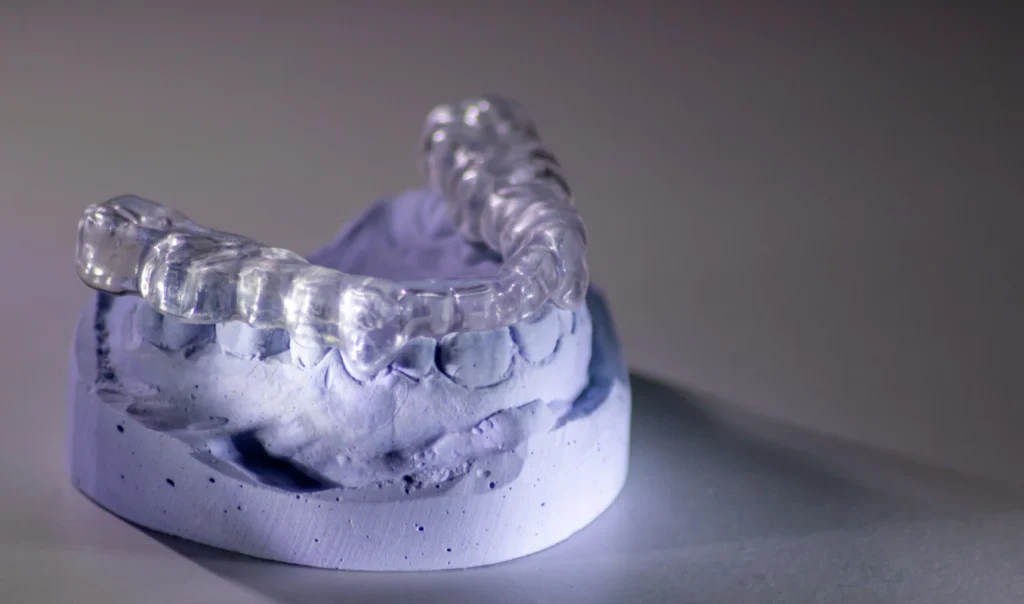 gouttiere bruxisme docteur baur truchtersheimBruxismeCabinet d’Orthodontie du Dr Bernard Baur