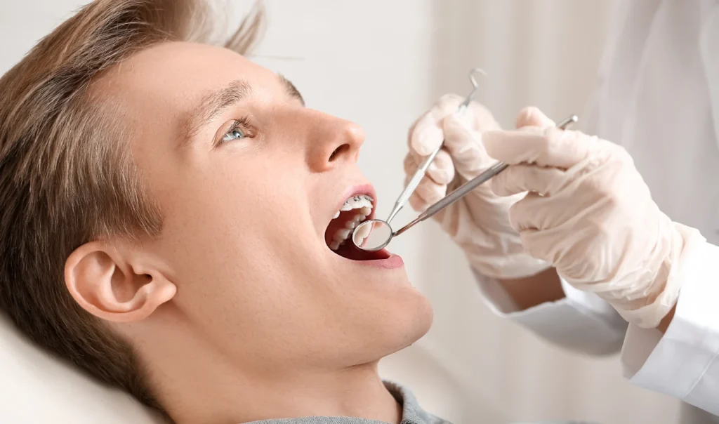 pose multi attaches adolescent docteur baurAppareils dentairesCabinet d’Orthodontie du Dr Bernard Baur